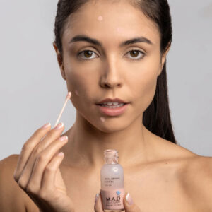 Model applying Acne Drying Lotion Sulfur 10%