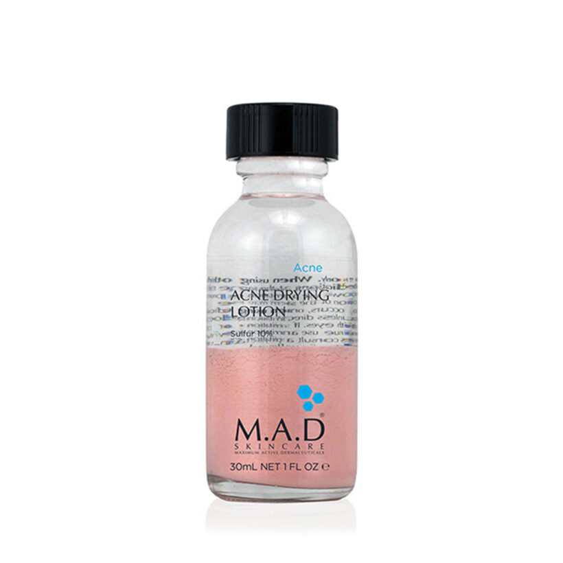 Acne Drying Lotion Sulfur 10%