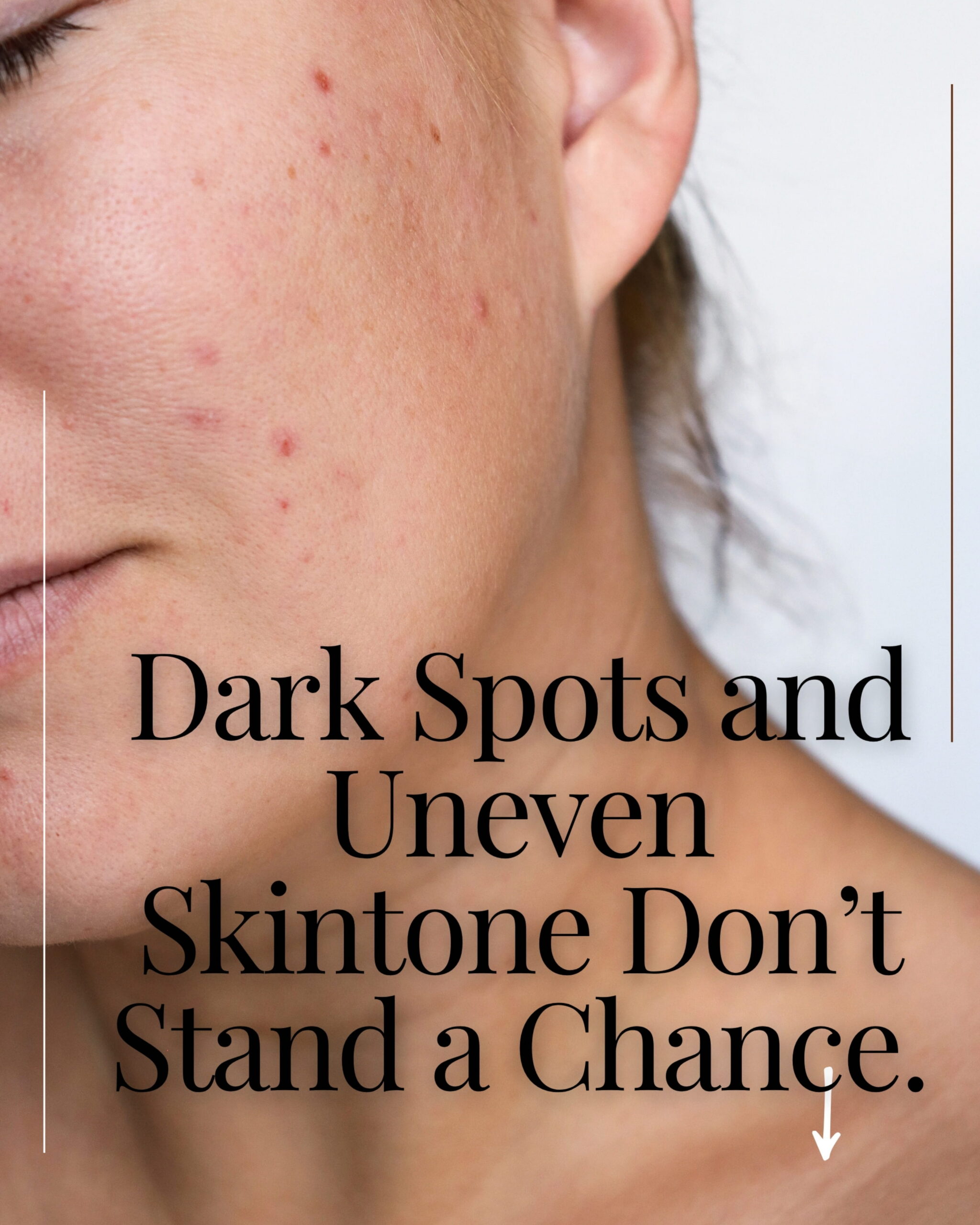 Woman with dark spots on skin