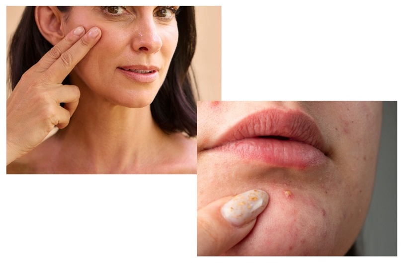 Glycolic Acid vs. Salicylic Acid Banner